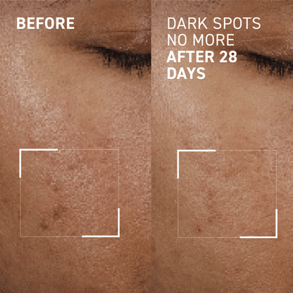 Dr Brandt Dark Spots No More Serum 15ml