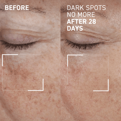 Dr Brandt Dark Spots No More Serum 15ml