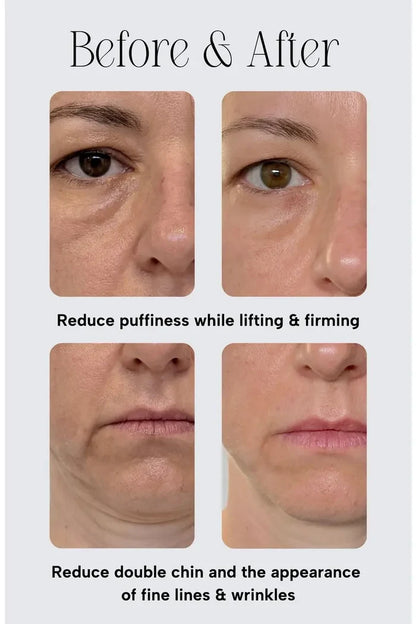 The De-Puffing Rose Quartz Facial Roller