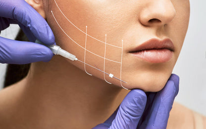 Thread Lift Consultation